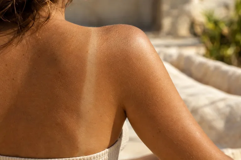 Een blote schouder in de zomerzon, van achteren gezien, met een licht bruiningsrandje